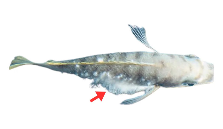 Sveppasýking (mycosis)